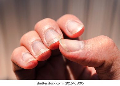 Dirty Fingernails Images Stock Photos Vectors Shutterstock