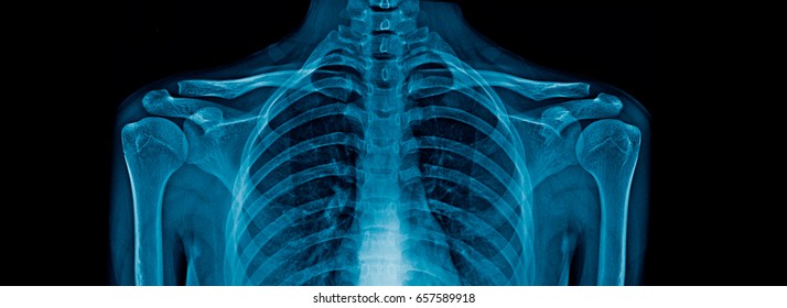 Very Good X-ray Upper Part Of Body