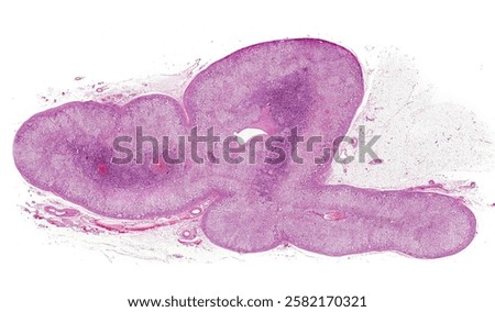 Very low magnification light micrograph of a sagittal section of a human adrenal gland showing the outer connective tissue capsule, the peripheral adrenal cortex, and the inner medulla,more basophilic
