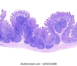 Very low magnification micrograph of a distal ileum showings a large aggregate of lymphoid follicles or Peyer’s patch.