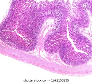 Jejunum Images, Stock Photos & Vectors | Shutterstock