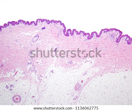 Very low magnification micrograph of thin skin showing the epidermis, the dermis and the adipose tissue of the hypodermis.
