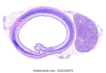 Very Low Power Light Microscope Micrograph Of A Cross Section Of The Trachea, Showing The Tracheal Mucosa, The C-shaped Cartilage Tracheal Rings, And A Lobule Of The Thyroid Gland. HE Stain.