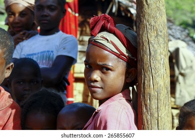 Very Pretty Malagasy Child Smiling In The Village- Poverty