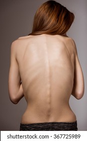 Very thin girl turned back and clearly visible spine and ribs close-up