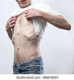 very thin man lift his t-shirt and looks for his chest.