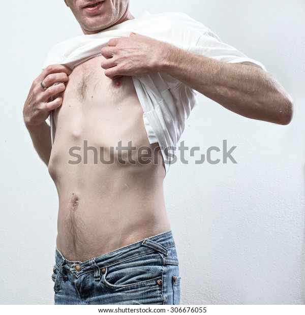 Very Thin Man Lift His Tshirt Stock Photo Edit Now 306676055