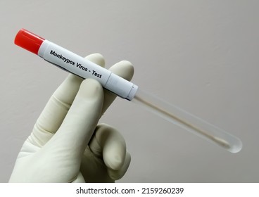 Vesicles fluid sample for Monkeypox virus test. It is also known as the Moneypox virus, a double-stranded DNA virus and member of Poxviridae family. - Shutterstock ID 2159260239
