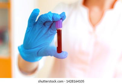 Vial Full Of Blood In The Hand Of A Laboratory Specialist. Woman's Hand In Blue Protective Glove Is Holding A Test Tube With Red Liquid. Close-up.