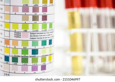 vial with test strips for urinalysis used to control ketosis and other 9 parameters, laboratory use by a healthcare professional