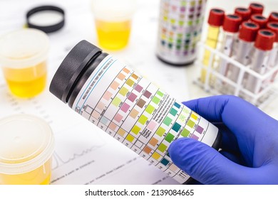 vial of Urinalysis Test Strip used for ketosis control and other 9 parameters such asLeukocytes, Urobilinogen, Bilirubin, Blood, Nitrite, pH, Density, Protein, Glucose and ketone bodies (ketosis)