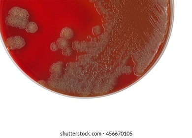 Трутовик окаймленный холерный вибрион. Холерный вибрион колонии. Vibrio cholerae гемолиз. ТЦБС агар холерный вибрион. Вибрионы на среде Эндо.