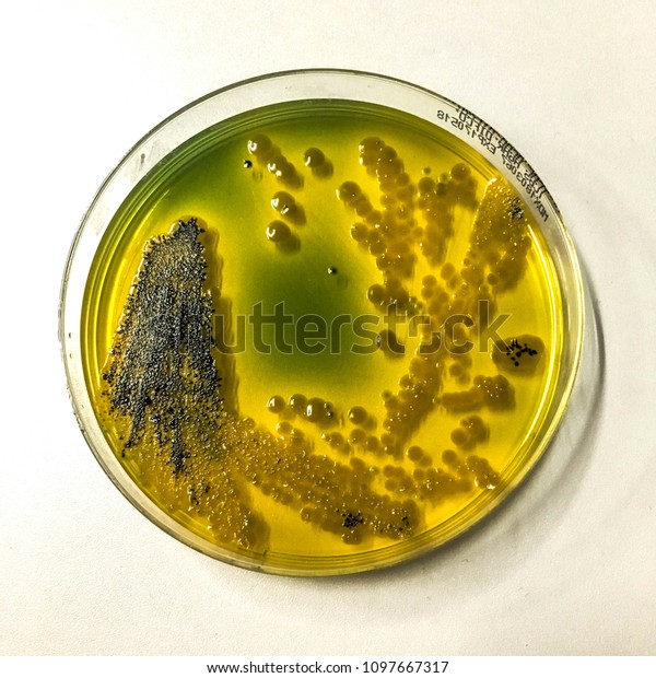 Vibrio Cholerae Gramnegative Commashaped Bacterium Bacteriums Stock ...