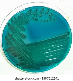 Vibrio Parahaemolyticus Growth On Thiosulfate Citrate Bile Salts Sucrose (tcbs)