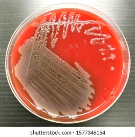 Vibrio Parahaemolyticus On Blood Agar