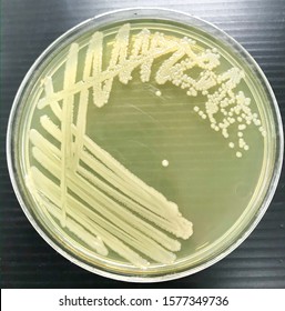 Vibrio Parahaemolyticus On TRYPTICASE SOY AGAR