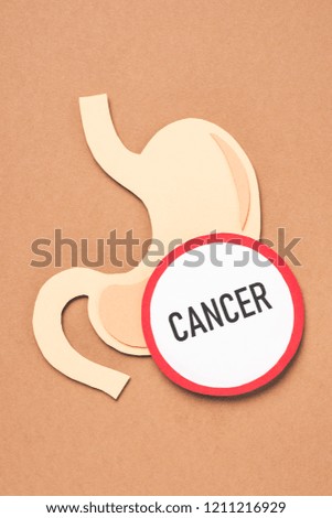 view from above of human stomach and lettering cancer on beige