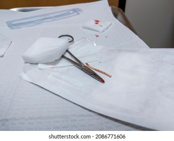 View Of A Birth Control Arm Implant, Freshly Removed, Sitting On A Medical Table With Some Gauze