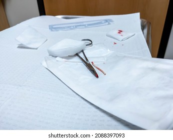 View Of A Birth Control Arm Implant, Freshly Removed, Sitting On A Medical Table With Some Gauze