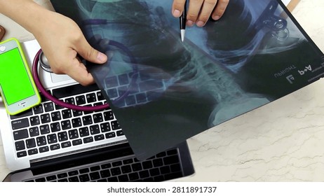 View of doctor checking x ray scan of patient. Doctor looking at lungs scan x-ray image. The Doctor hands with medical x ray of human chest scan.