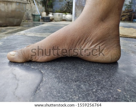 The view of the health condition on human foot 
