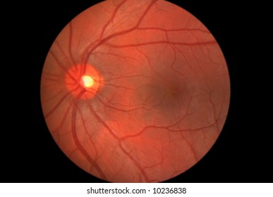 View inside human eye - showing retina, optic nerve and macula