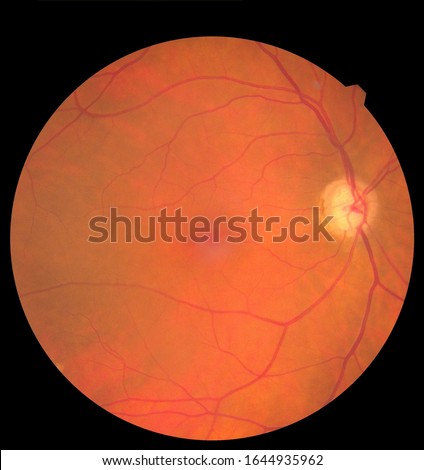 View inside human eye showing retina, optic nerve and macula. Health concept