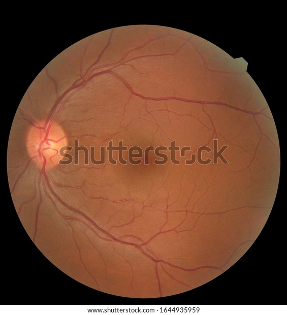 View inside human eye showing retina, optic nerve\
and macula. Health concept
