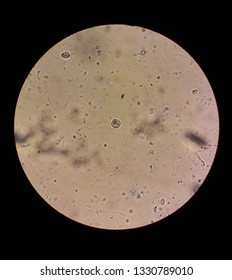 View in the microscope on Trichomonas STD