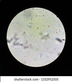 View In The Microscope On Trichomonas STD