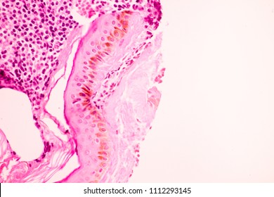 View In Microscopic Of Human Breast Tissue Section Show Ductal Epithelial Cell  By Hemotoxylin And Eosin Stain (H And E) In Laboratory. Cytology And Pathology Diagnosis Concept. 