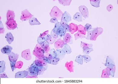 View In Microscopic Of Human Skin Cells.Squamous Epithelium Cells.Superficial And Intermediate Epithelial Cells.Cytology And Pathology Laboratory Department.Magnification 400 X