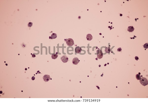 View Microscopic Macrophages Histiocytes Cytology Slide Stock Photo ...