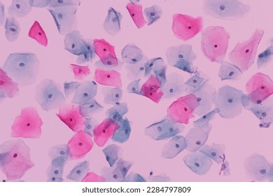 View in microscopic of normal human cervix cells.Squamous epithelial cells.Photo of Human skin cells.Superficial and intermediate epithelial cells.Cytology and pathology laboratory department.