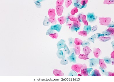 View in microscopic of normal human cervix cells.Squamous epithelial cells from pap smear cervixl and vaginal woman.Cervical cancer screening test.