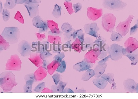 View in microscopic of normal human cervix cells.Squamous epithelial cells.Photo of Human skin cells.Superficial and intermediate epithelial cells.Cytology and pathology laboratory department.