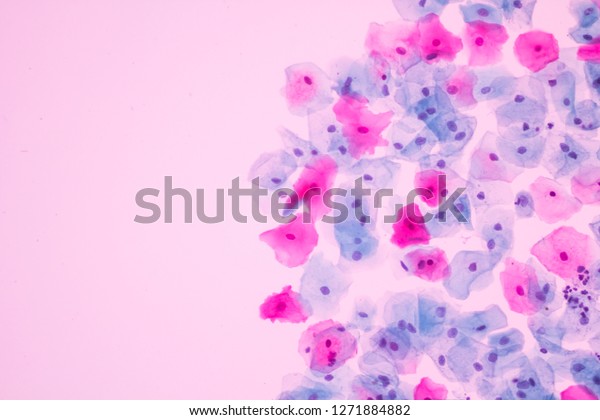 View in microscopic of normal human cervix cells with\
free space background.Superficial and intermediate cell lining of\
vagina in pap smear slide.Cytology and pathology laboratory\
department.600 X.