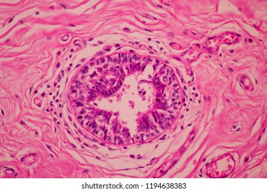 View Microscopic Pathology Cross Section Tissue Stock Photo (Edit Now ...