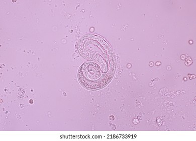 View In Microscopic Strongyloides Stercoralis Or Threadworm In Human Stool.Parasite Infection.Medical Background Analyze By Microscope, Original Magnification 400x