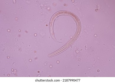 View In Microscopic Strongyloides Stercoralis Or Threadworm In Human Stool.Parasite Infection.Medical Background Analyze By Microscope, Original Magnification 400x