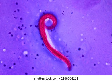 View In Microscopic Strongyloides Stercoralis Or Threadworm In Human Stool.Parasite Infection.Medical Background Analyze By Microscope, Original Magnification 400x