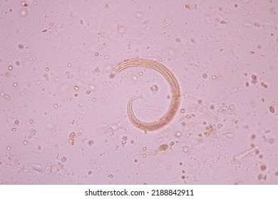 View In Microscopic Strongyloides Stercoralis Or Threadworm In Human Stool.Parasite Infection.Medical Background Analyze By Microscope, Original Magnification 400x