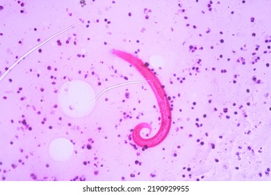 View In Microscopic Strongyloides Stercoralis Or Threadworm In Human Stool.Parasite Infection.Medical Background Analyze By Microscope, Original Magnification 400x