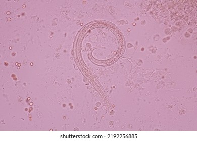 View In Microscopic Strongyloides Stercoralis Or Threadworm In Human Stool.Parasite Infection.Medical Background Analyze By Microscope, Original Magnification 400x