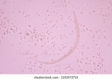 View In Microscopic Strongyloides Stercoralis Or Threadworm In Human Stool.Parasite Infection.Medical Background Analyze By Microscope, Original Magnification 400x