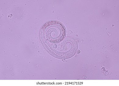 View In Microscopic Strongyloides Stercoralis Or Threadworm In Human Stool.Parasite Infection.Medical Background Analyze By Microscope, Original Magnification 400x