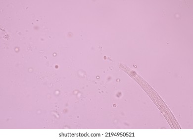 View In Microscopic Strongyloides Stercoralis Or Threadworm In Human Stool.Parasite Infection.Medical Background Analyze By Microscope, Original Magnification 400x