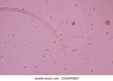 View In Microscopic Strongyloides Stercoralis Or Threadworm In Human Stool.Parasite Infection.Medical Background Analyze By Microscope, Original Magnification 400x