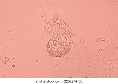 View In Microscopic Strongyloides Stercoralis Or Threadworm In Human Stool.Parasite Infection.Medical Background Analyze By Microscope, Original Magnification 400x