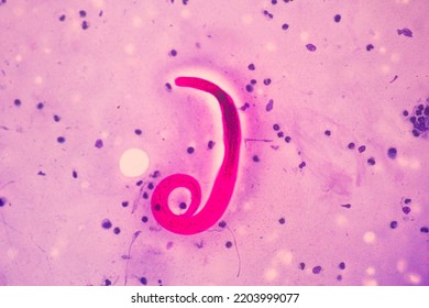 View In Microscopic Strongyloides Stercoralis Or Threadworm In Human Stool.Parasite Infection.Medical Background Analyze By Microscope, Original Magnification 400x